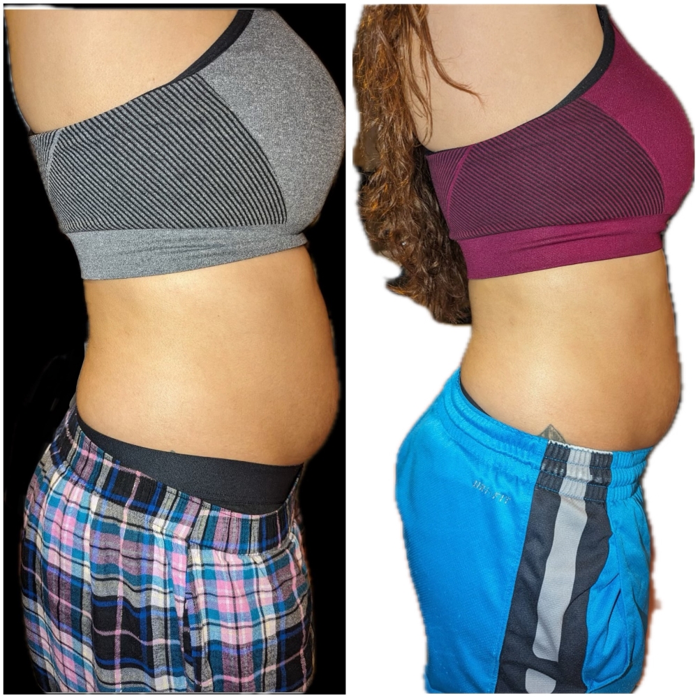 Lymphatic Drainage & Body Sculpting at A Cameo Appearance in Sioux Falls, SD