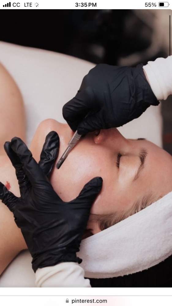Dermaplaning Facial