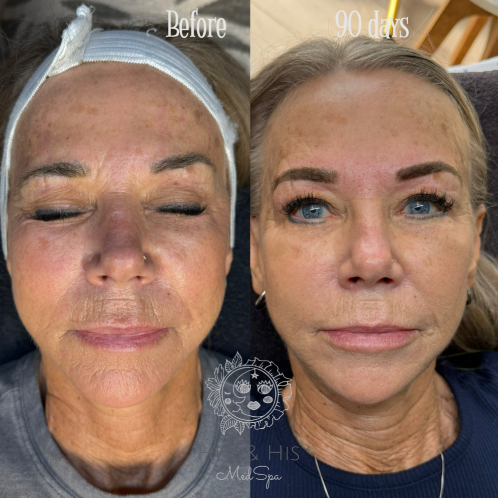 Lucente at Her & His in Longview, TX