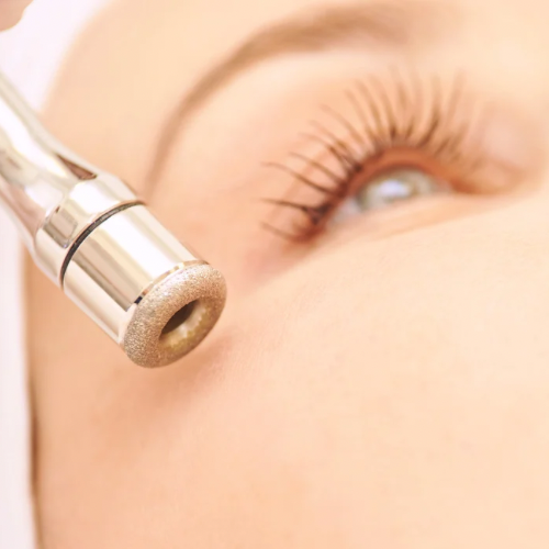 Microdermabrasion Polish