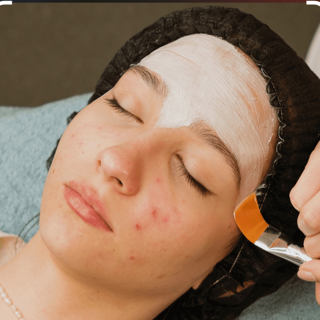 Acne treatment plan facial at Skin sense by joi in Hypoluxo, FL