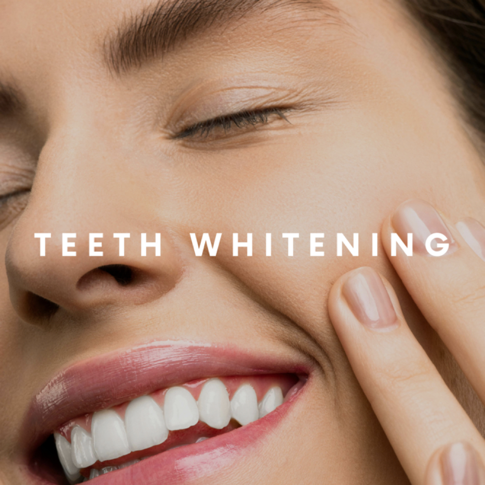 Teeth Whitening Single at The SunLab Tanning Co at Making Face Spa in Amherst, OH
