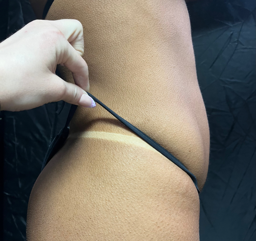 Spray tan