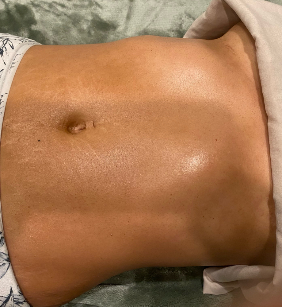 Brazilian lymphatic massage at The Spa Unicorn By appointment only in Claremont, CA
