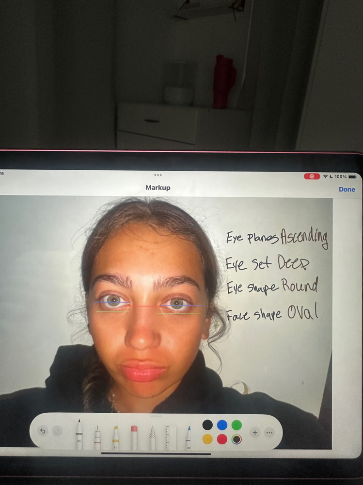 Eye Analysis