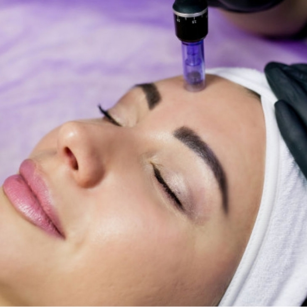 Microneedling at REFRESH BEAUTY BAR in Hampstead, NC