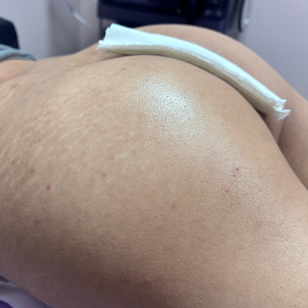 Butt Cheeks Sugaring at Mo3 Beauty Studio in Vestavia Hills, AL