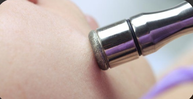 Add On Dermabrasion
