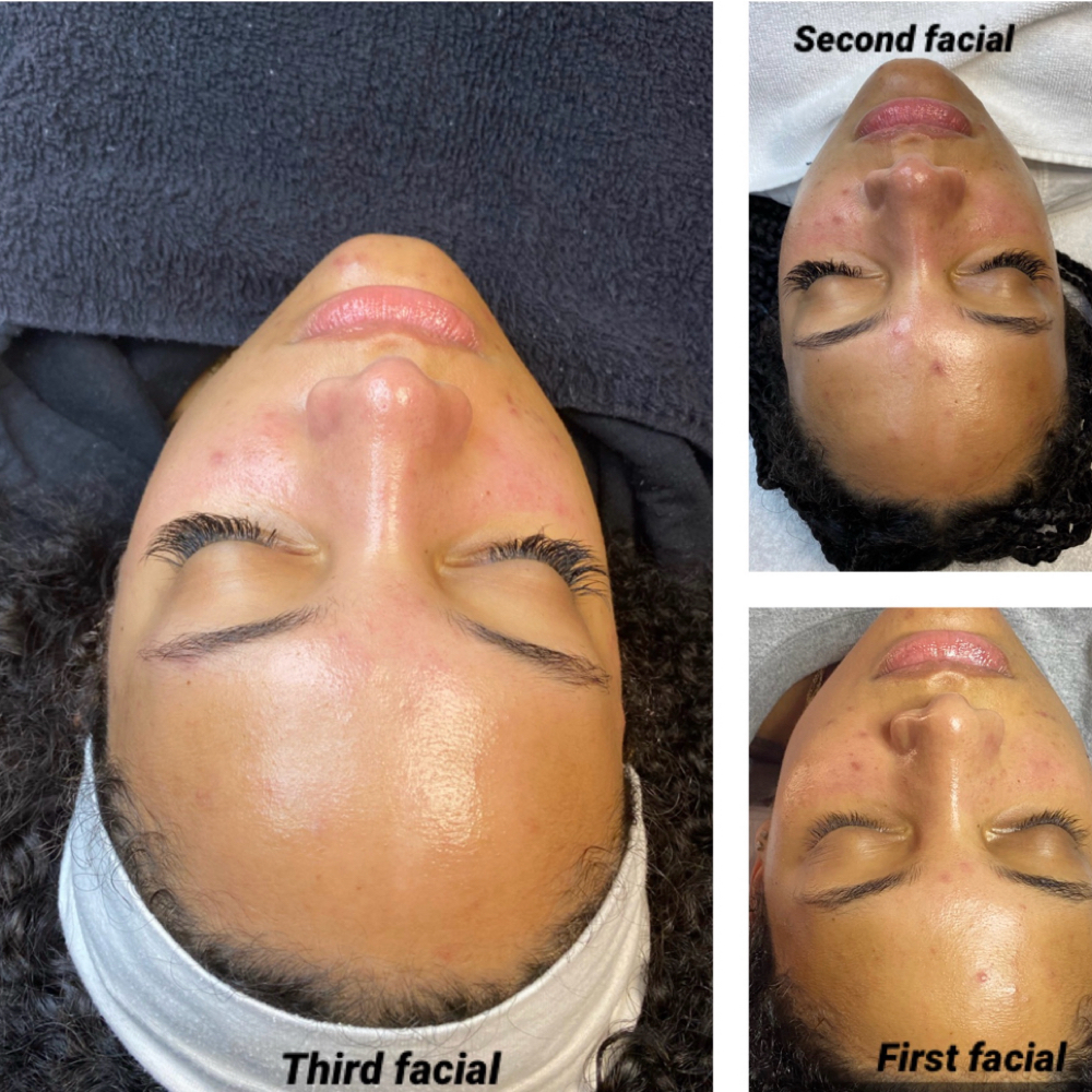SKIN CONSULTATION & INTRO FACIAL at Beauty Therapy by Chanel in Tucker, GA