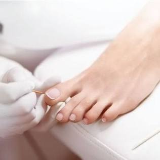 NAIL CURE (Toenail Recovery) at Nail Cure by Jashmia LLC in Brookfield, WI