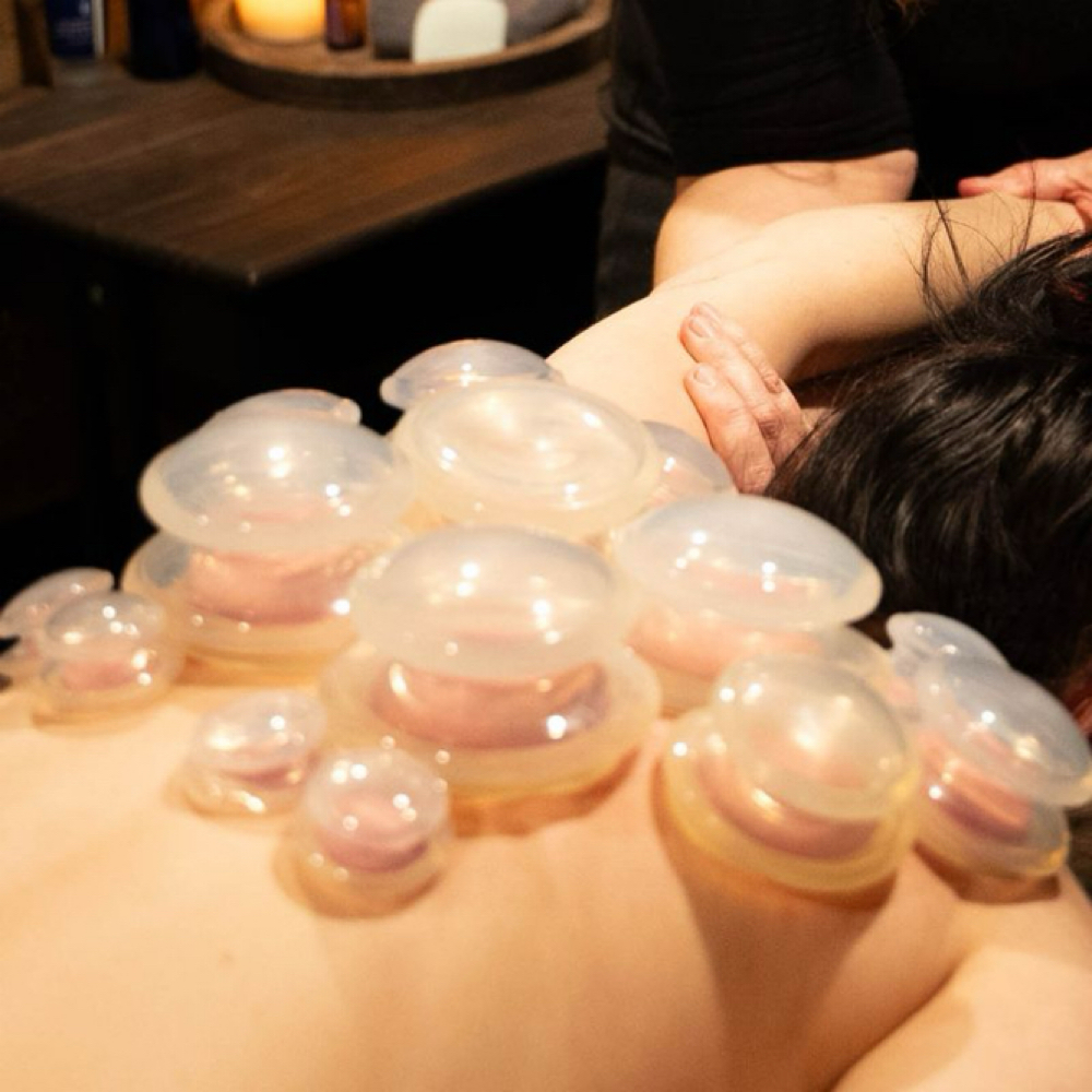 Cupping at Sono A Terra Massage & Bodywork in Blue Springs, MO