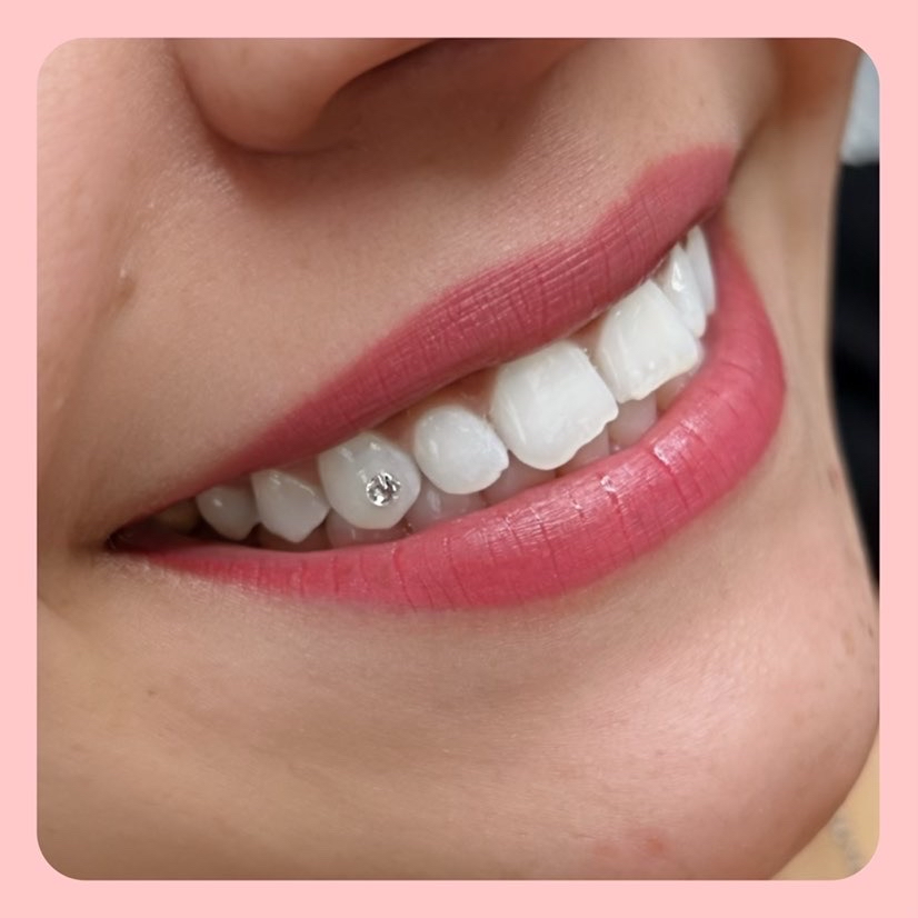 * Tech Free Style 4-6 Teeth