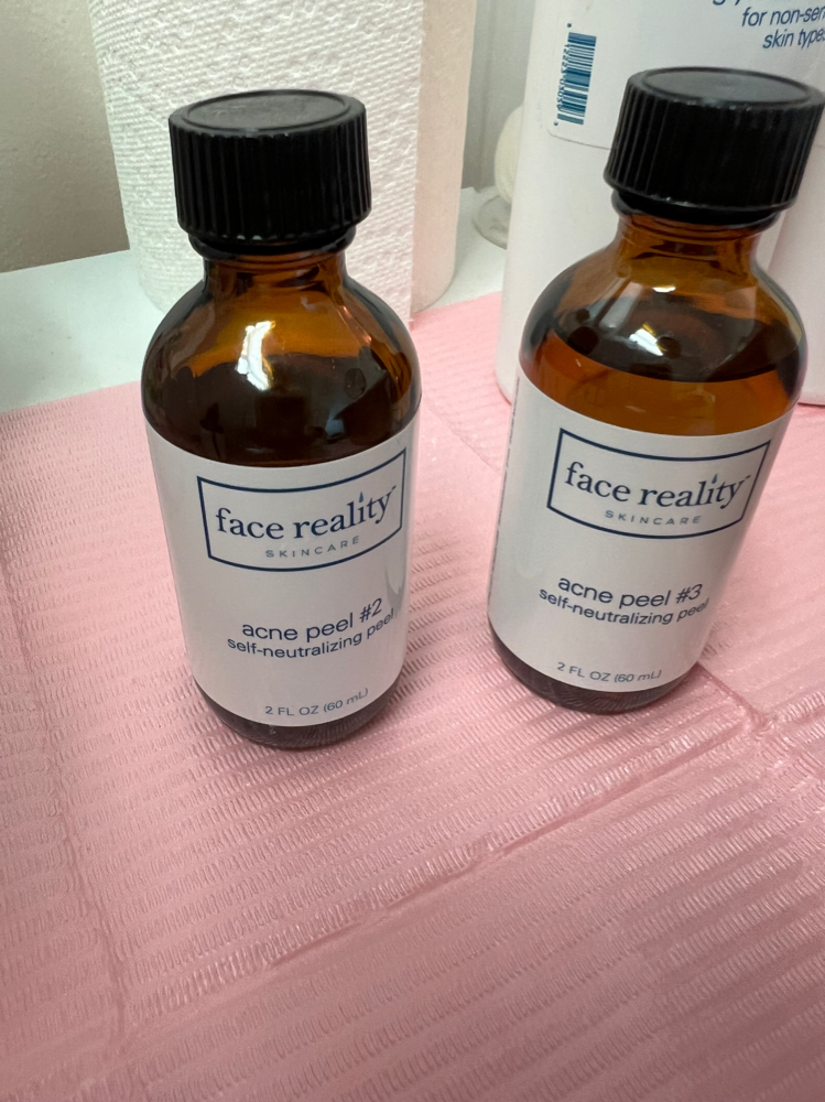 Acne Treatment-Chemical Peel