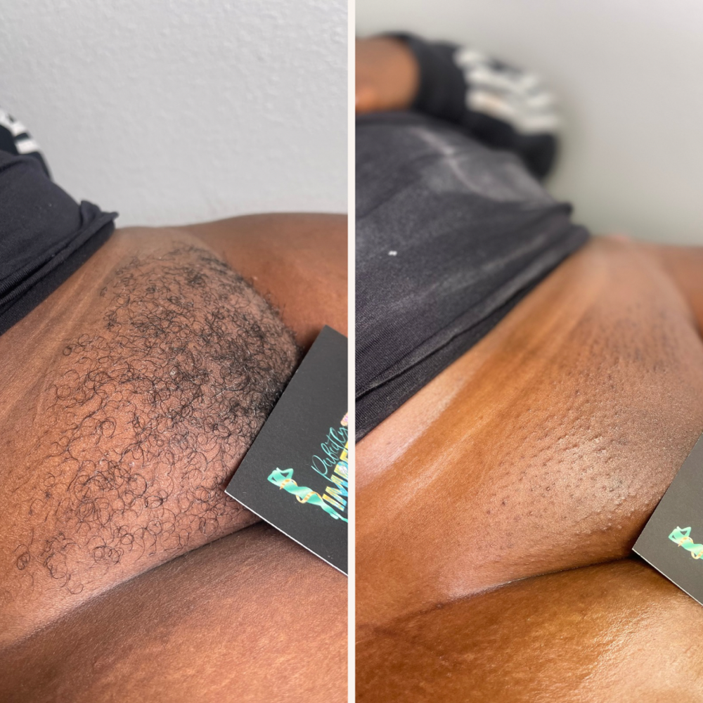 Brazilian Wax Maintenance