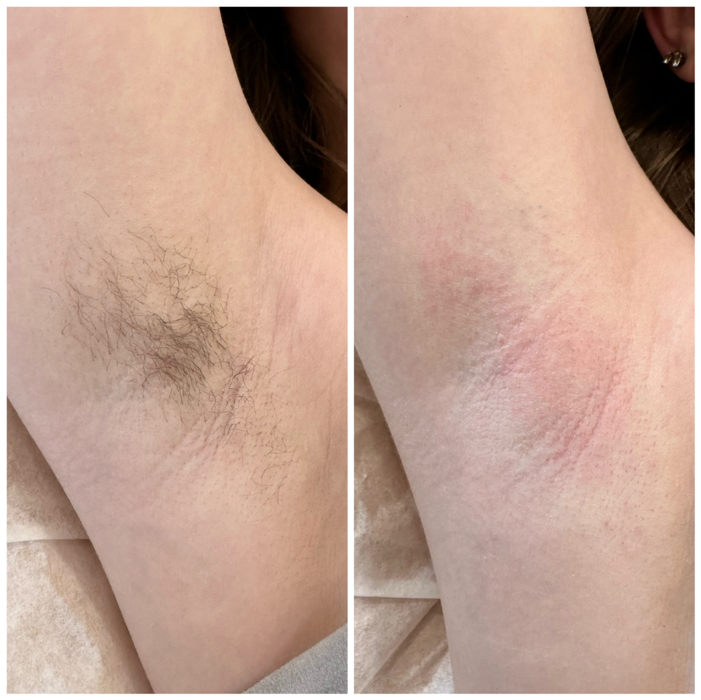 Underarm Wax