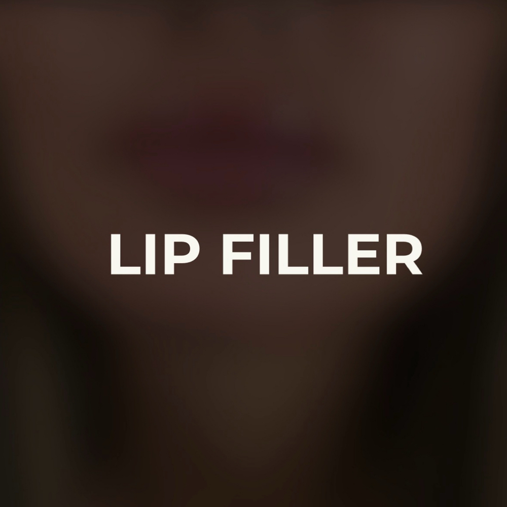 The Signature Kiss Lip Augmentation at Turtle Creek Aesthetics in Texas, TX