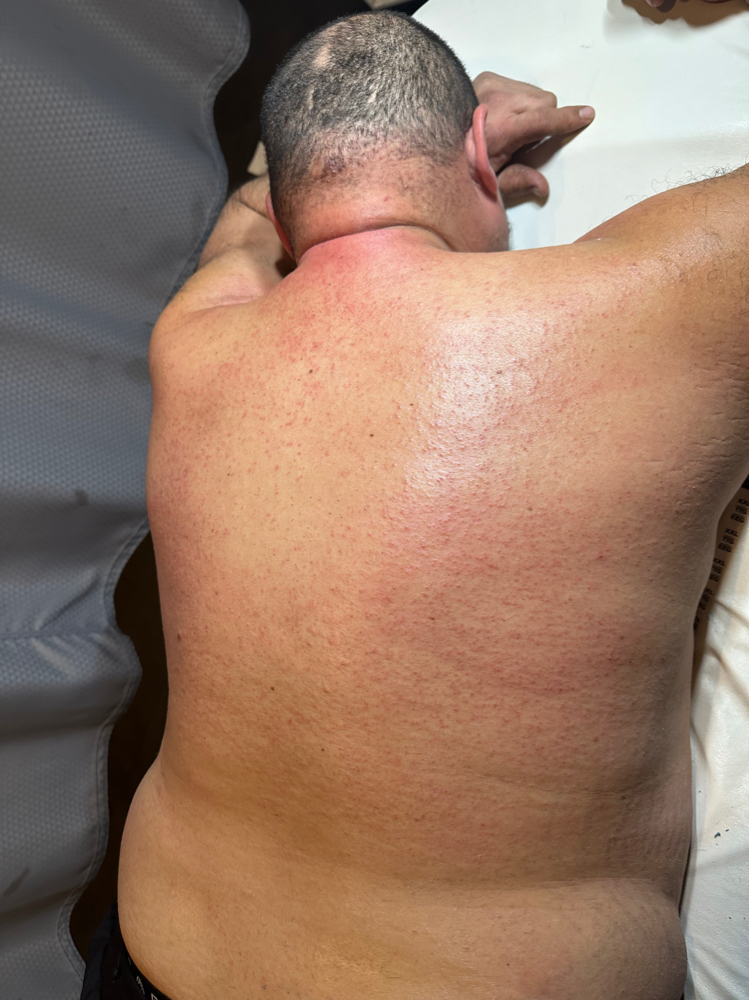 Men’s Back Wax