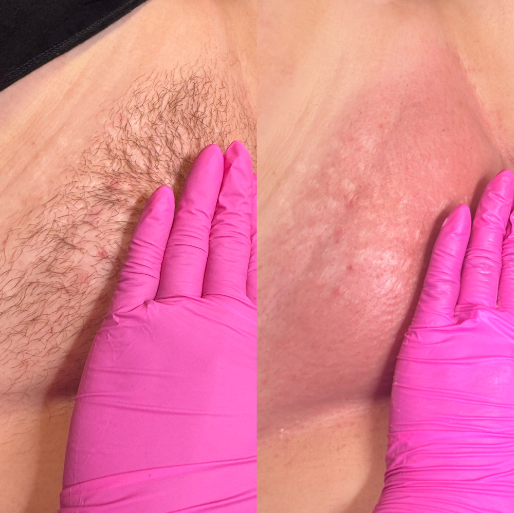 Brazilian Wax