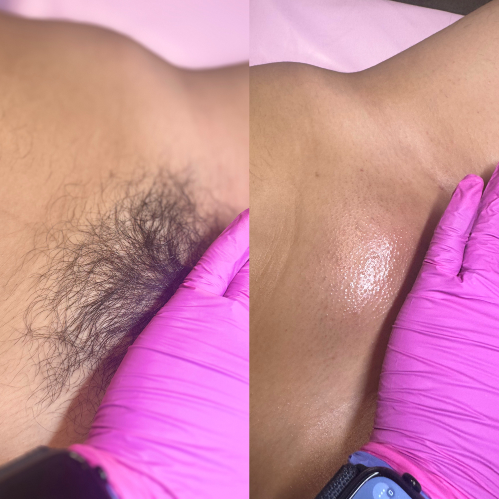 Brazilian Wax at Glow on the Go in Converse, TX