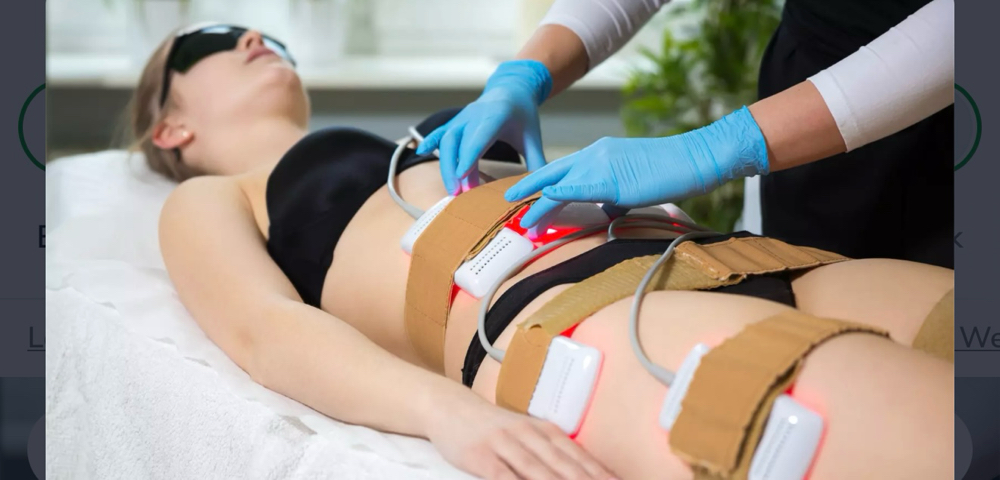 Fat Melting Liposysis Add On