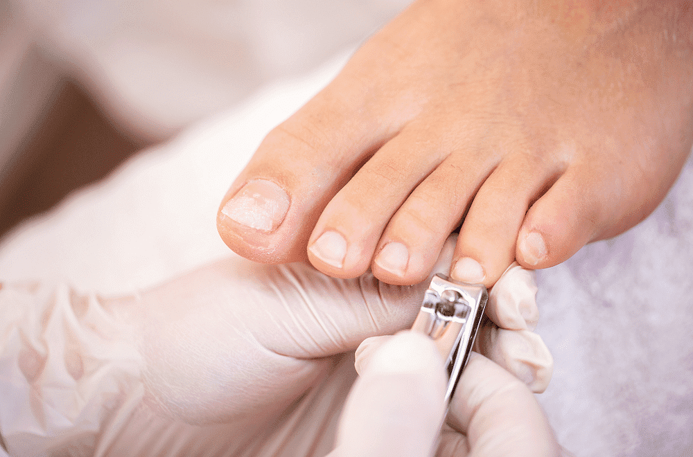 Toe Nail Trim / Ingrown Removal