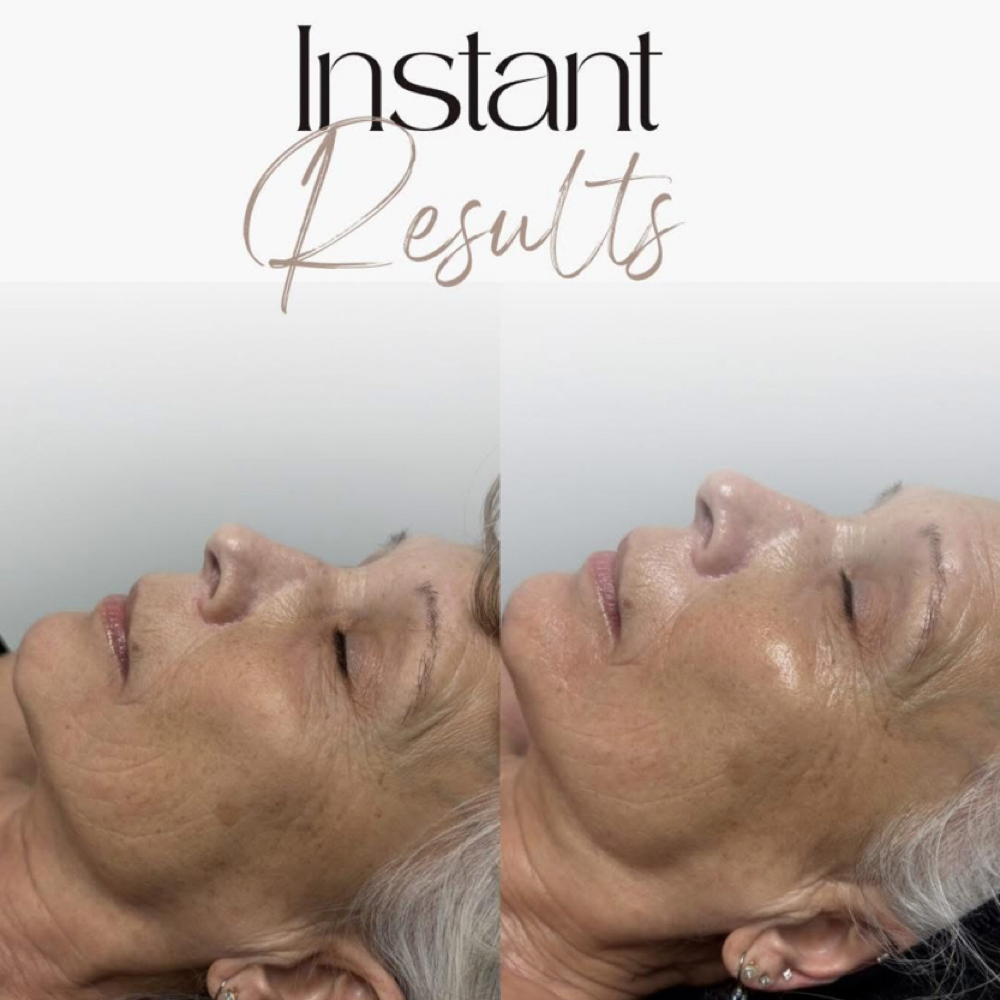 Deluxe Lifting Facial at Jennalee Hair + Skin in Fort Pierce, FL
