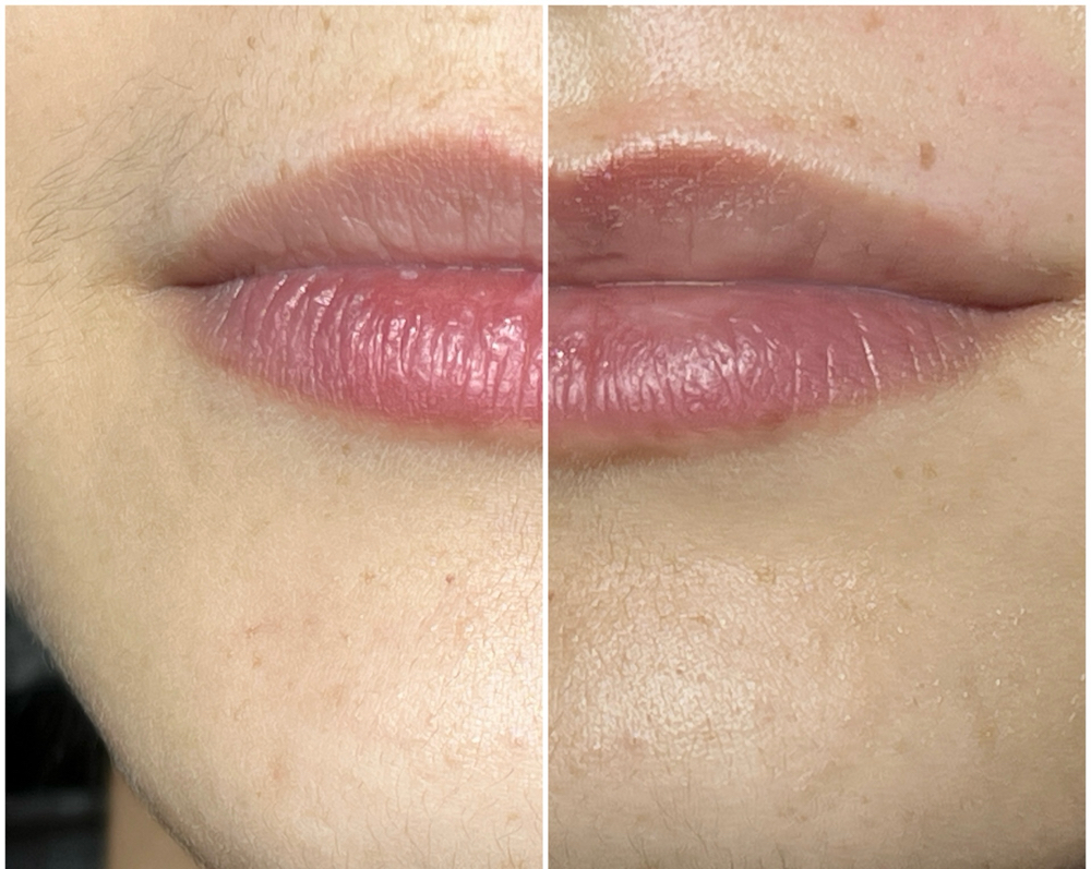 UPPER LIP WAX