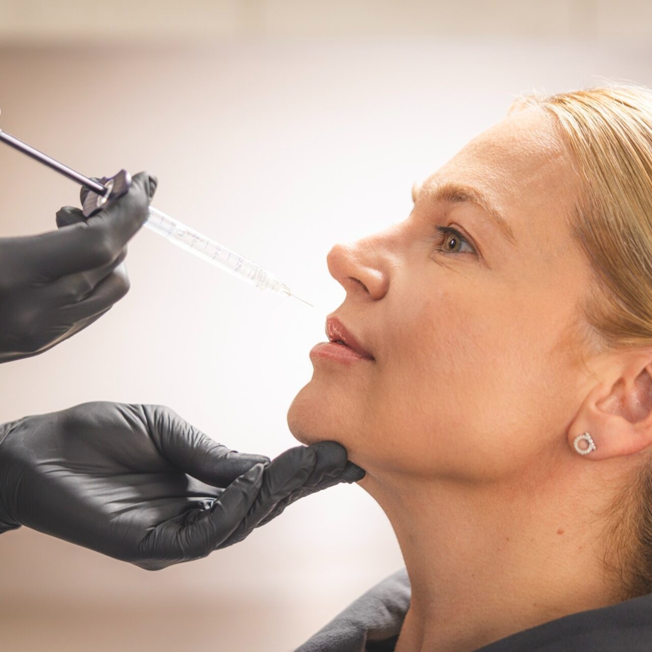 Hyaluronic Acid Filler Dissolving at RevIVeU Fairmont in Fairmont, WV