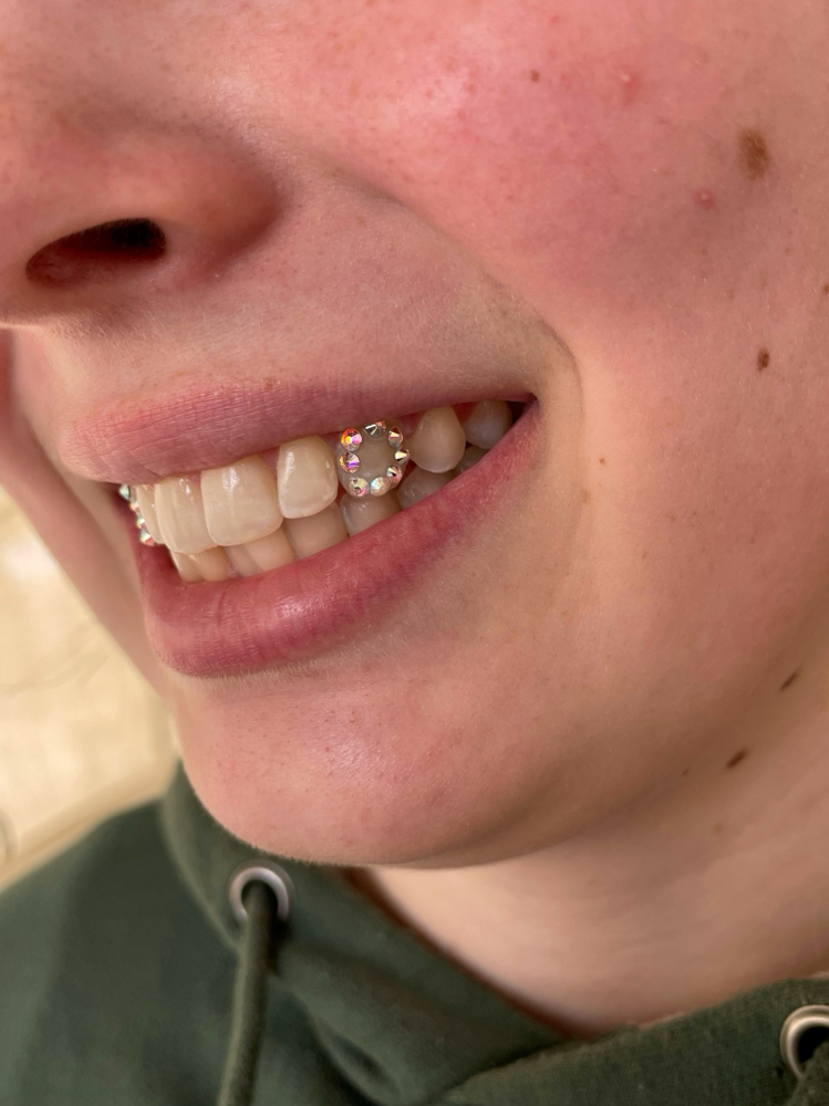 Window Tooth