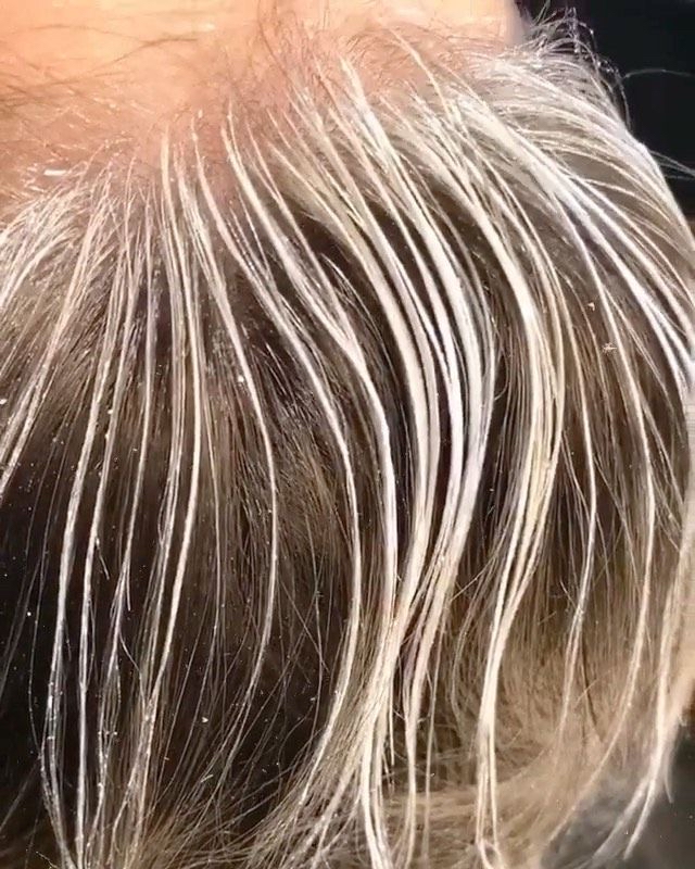 Mini Blonding