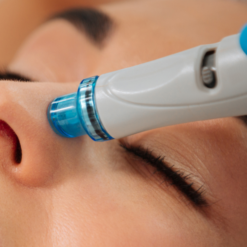 HydroInfusion Facial at Mne Aesthetics in Missouri City, TX