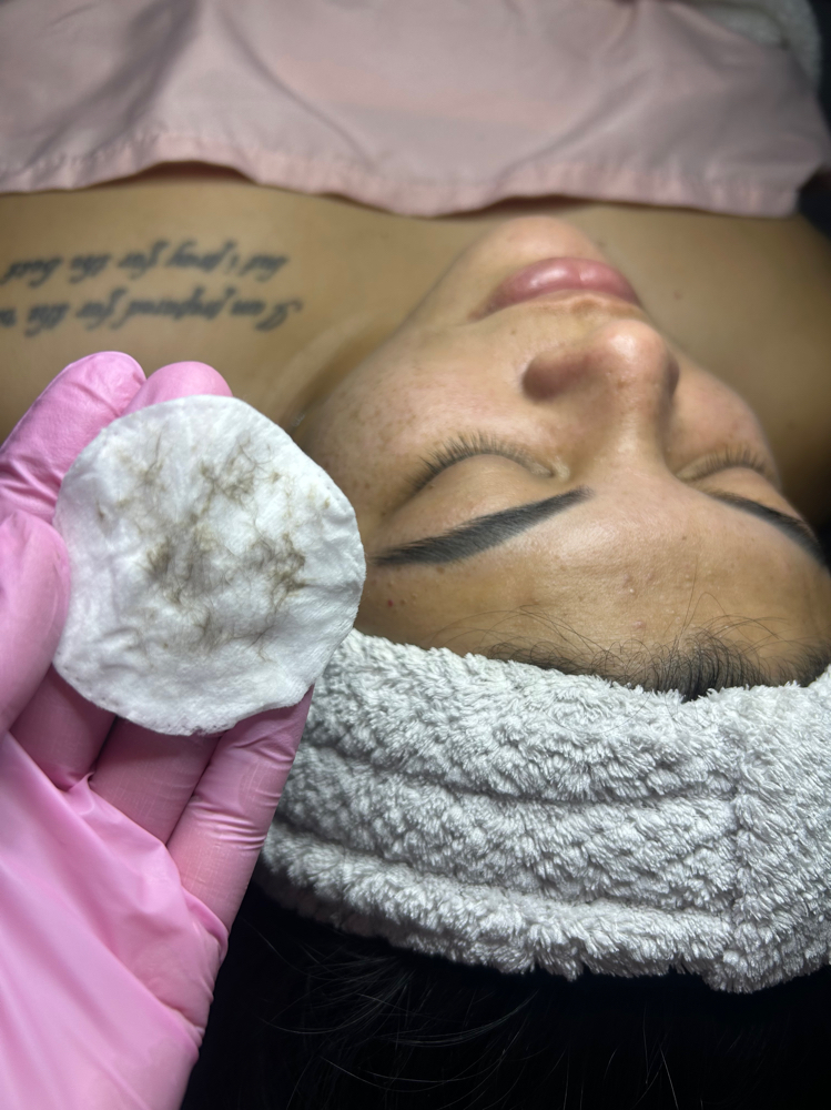 Dermaplanning Add On