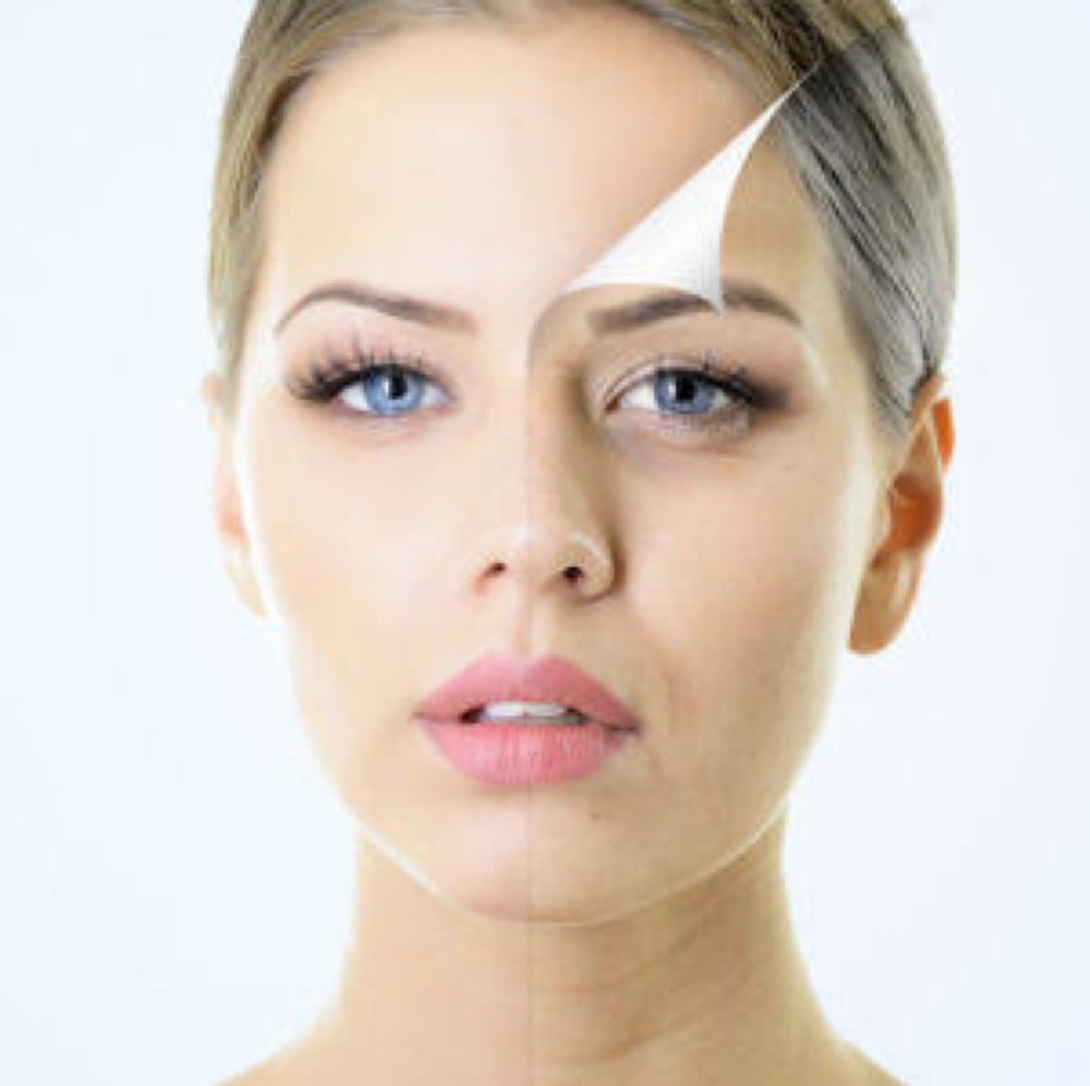 Chemical Peels at One & Only Esthetics in Kansas City, MO
