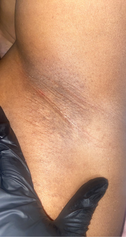 Underarm Wax