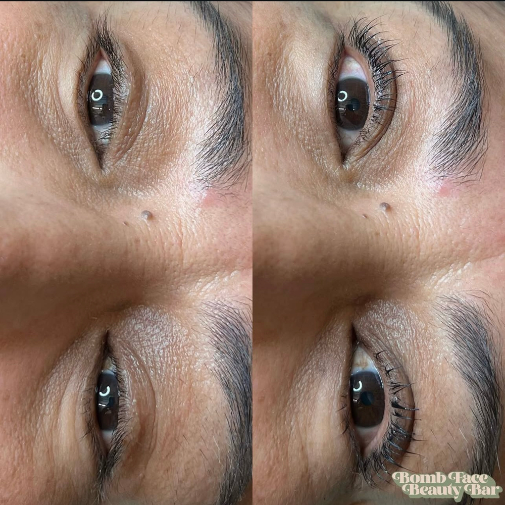 Lash Lift