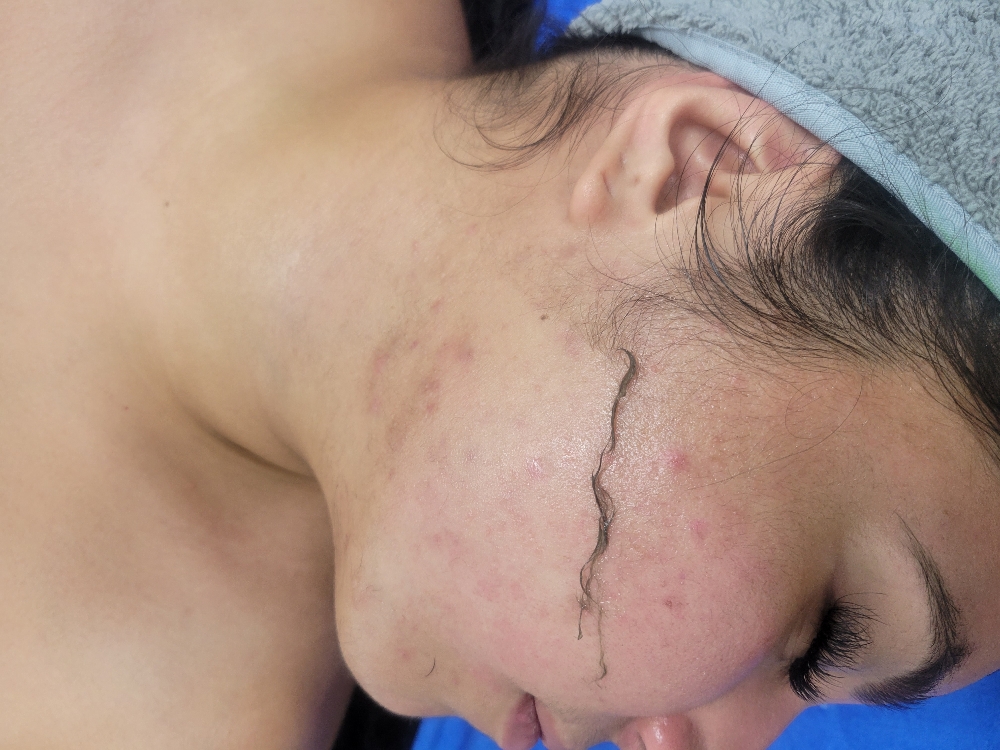 Dermaplaning Facial
