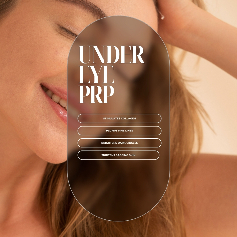 PRP/PRF Undereye Treatment