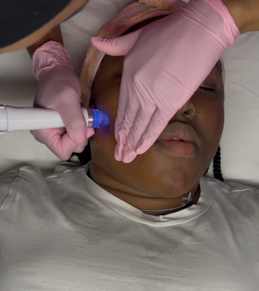 The Skin Detox Facial at Zelle Aesthetics in Bedford, TX