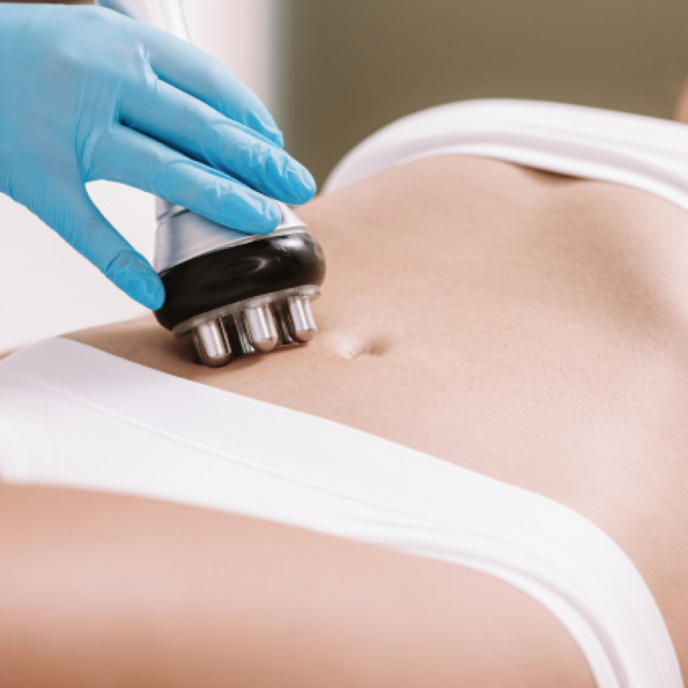 RF Body Skin Tightening at Wild Rose Med Spa in Chanhassen, MN