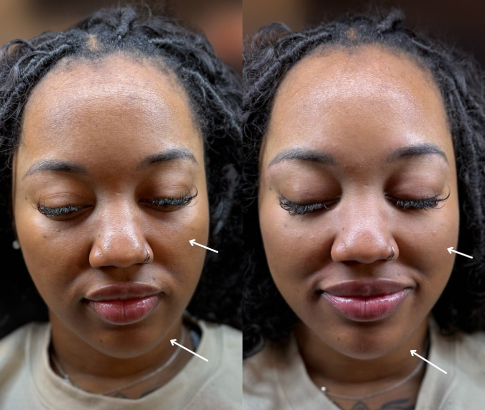 Facial Sculpt Packages