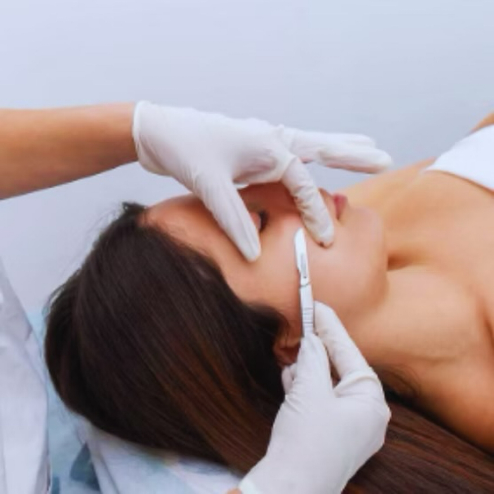 Fuzzies be Gone- Dermaplaning at Healing Hands by Karen in Providence, RI