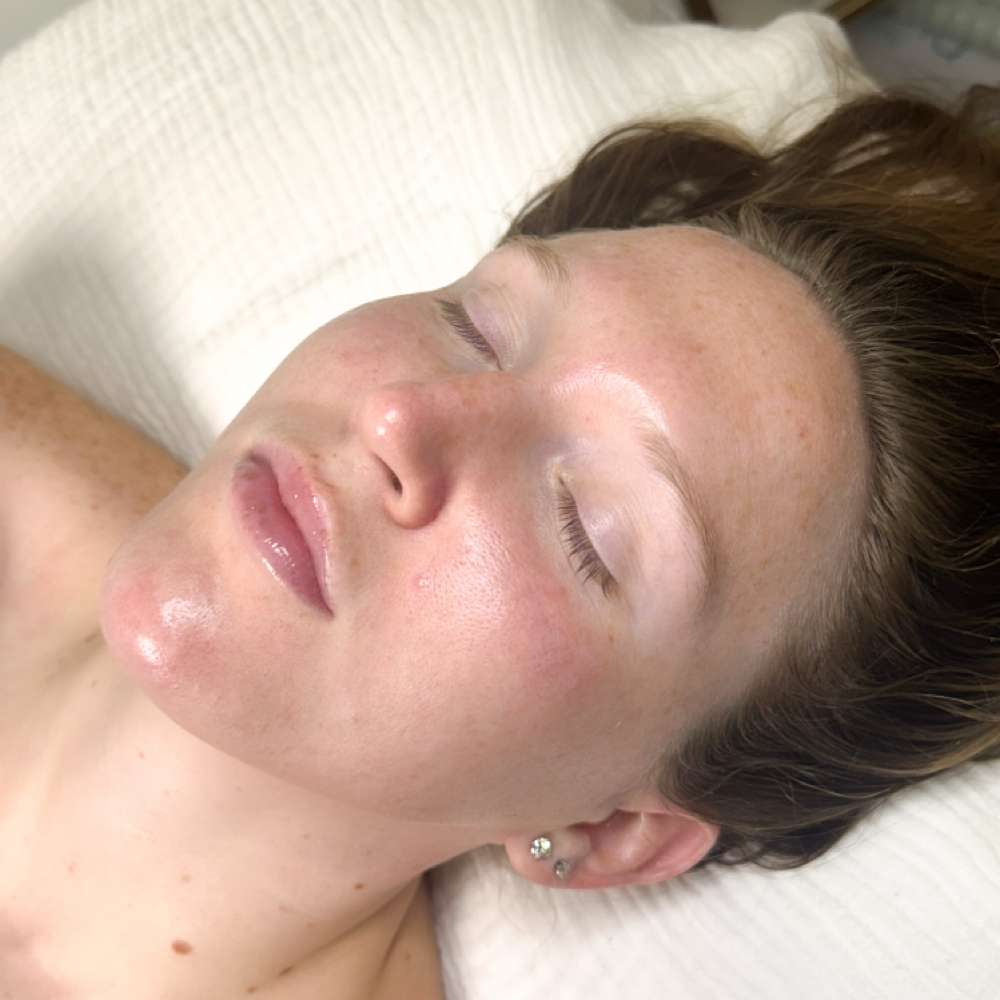 Supreme Glow Customized Facial at Pearis Eller Aesthetics in Port Wentworth, GA
