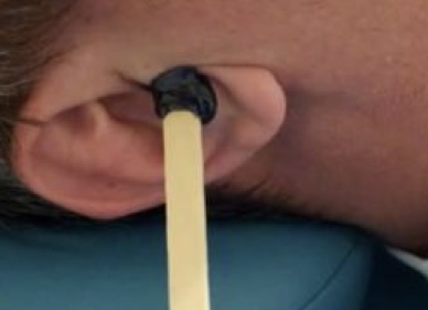 Ear Wax