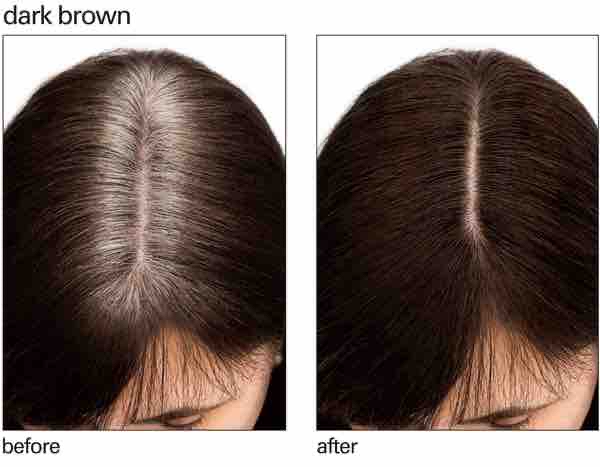 Root Retouch