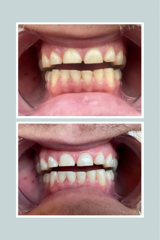 Teeth Whitening at Jamie Turk in Eugene, OR