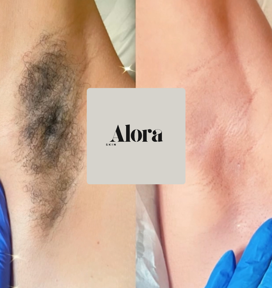Underarm Wax