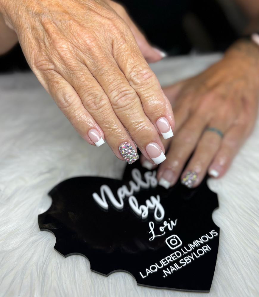 Structred Gel Overlay