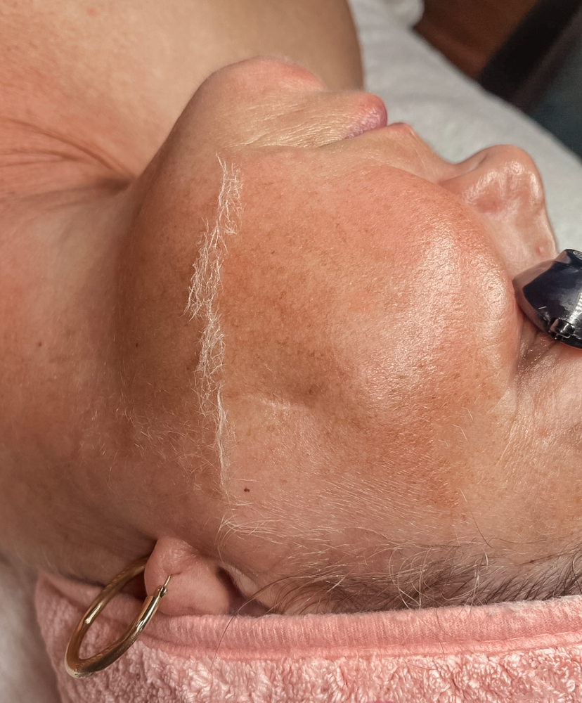 DERMAPLANING + ENZYME FACIAL