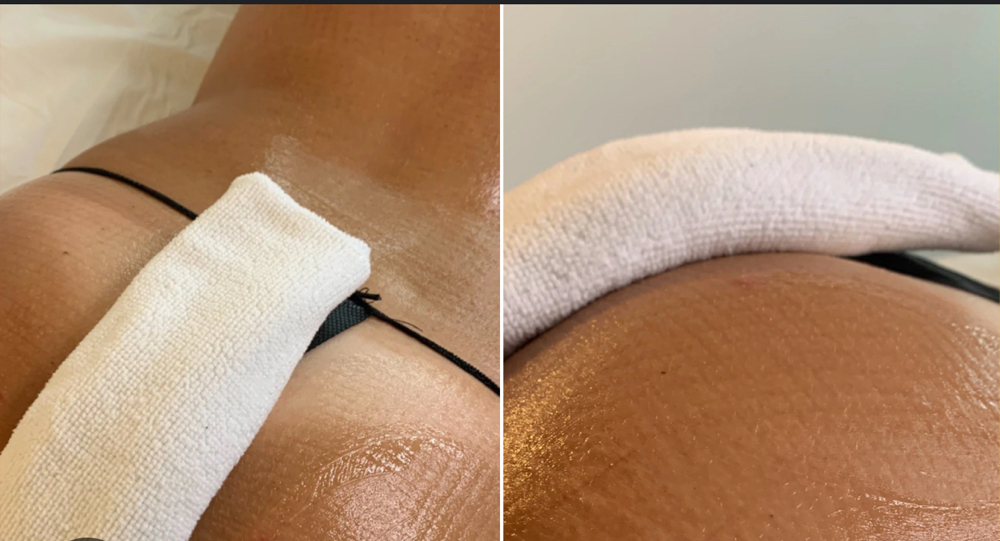 🍑 Glow & Go Booty Facial