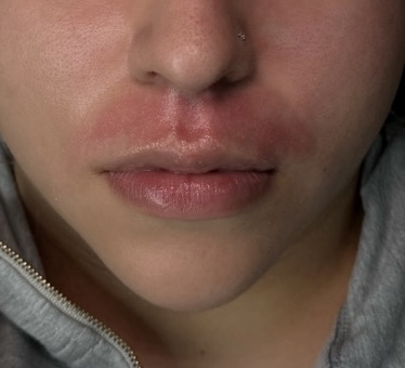 Lip Wax/Depilacion De Labio